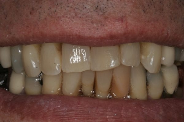 cosmetic dentist birmingham al patient photo