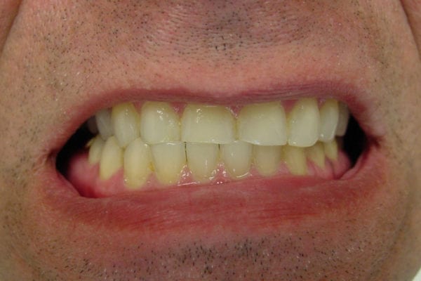 cosmetic dentist birmingham al patient photo